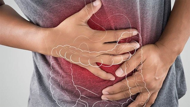 Sri Lanka's Youth Face Rising Intestinal Disorders Linked to Diet and Stress, Experts Warn