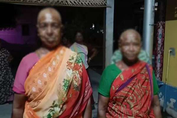 புது நோய் வருது ; மொட்டை அடித்து ஏமார்ந்த பெண்கள்