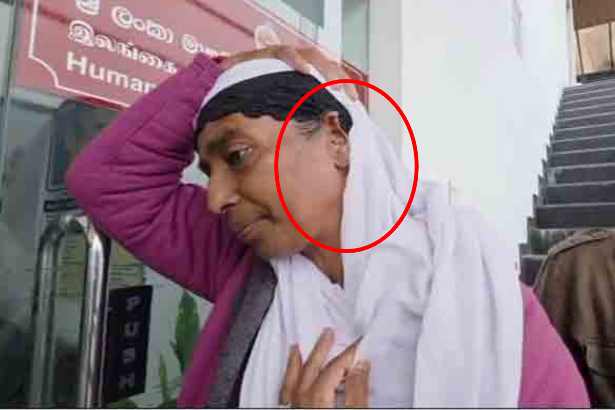 பெண்ணின் காதைக் கடித்த விவகாரம்: 6 மாதமாக நீதி கிடைக்கவில்லை!