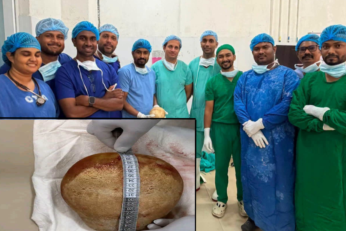 திருக்கோணமலை மருத்துவமனை 3 கிலோ சிறுநீரக கல்லை அறுவைசிகிச்சையில் நீக்கியது - மைல்கல் சாதனை