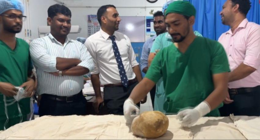 Trincomalee Hospital Removes 3.1kg Bladder Stone in Potential World Record Surgery